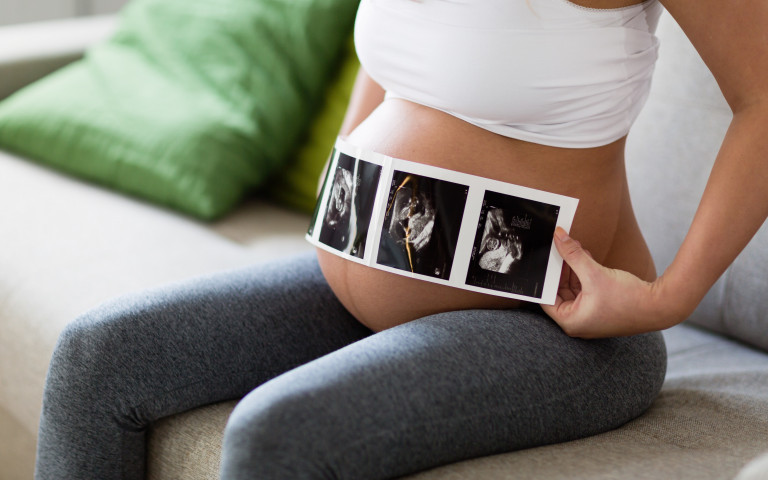 Vrouw met echo voor zwangere buik