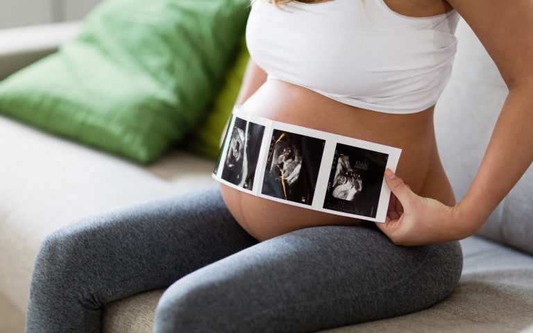 Zwangere vrouw met echographie op de buik