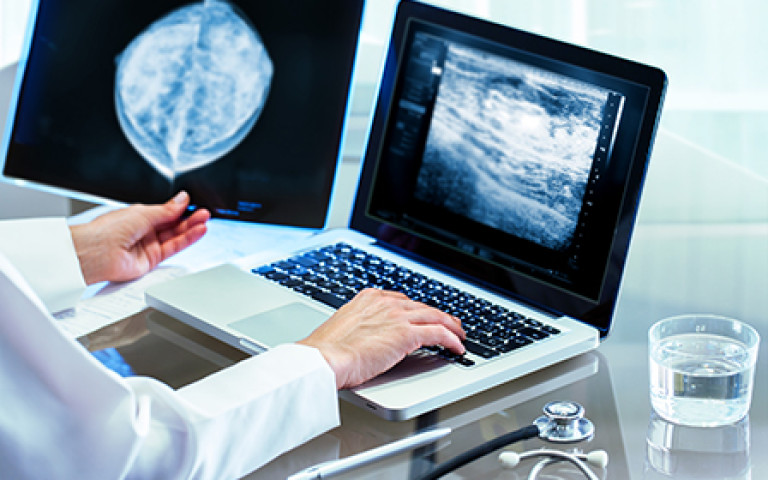 mammografie onderzoeksresultaten digitaal