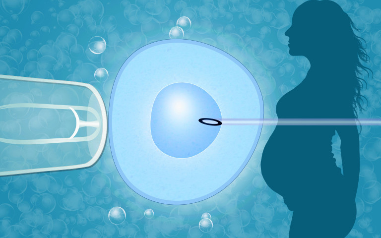 Procréation médicalement assistée et fécondation in-vitro