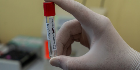 COVID-19-test in hand van onderzoeker