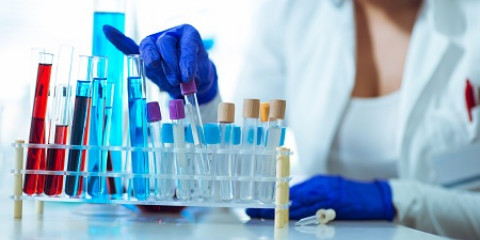 Laboratorium setting onderzoek stalen