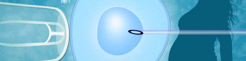 Procréation médicalement assistée et fécondation in-vitro