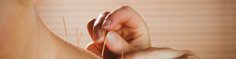 Behandeling acupunctuur nek en schouders