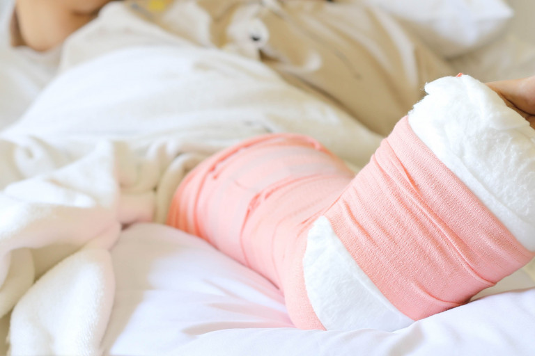 gebroken been in ziekenhuis