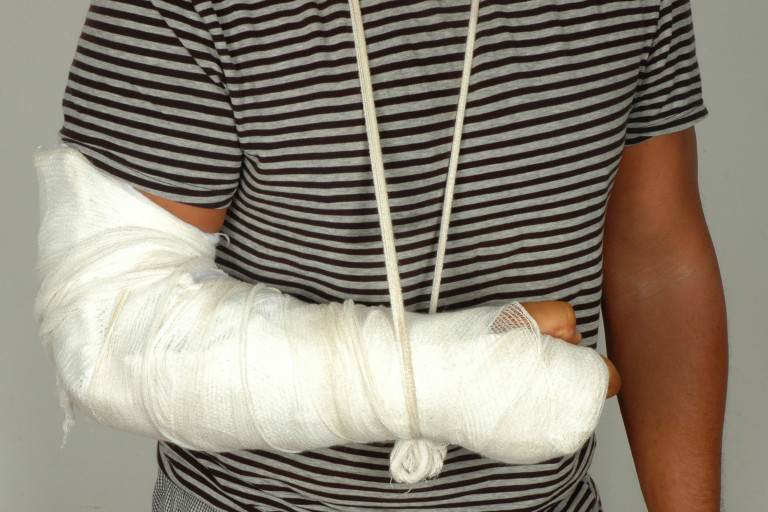 Man met arm in gips